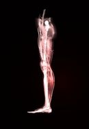 Image converted using ifftoany sciatica remedy