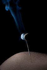 acupuncture and pregnancy