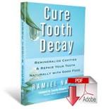 Cure Tooth Decay book Cure Tooth Decay book