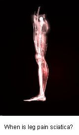 sciatica causing leg pain