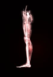 Image converted using ifftoany sciatic nerve