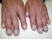 fingernails