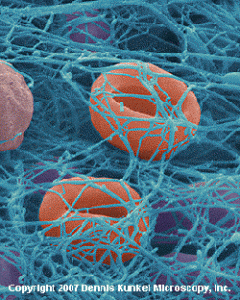 fibrin-250w proteolytic enzymes