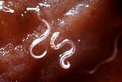 common parasites common parasites