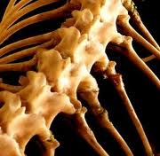 The Newest Spinal Decompression Treatment Programs
