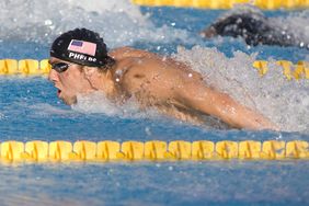 Cupping: Olympic Athletes' Ancient Pain Relief Strategy from Traditional Chinese Medicine