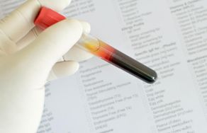 'Sticky Blood': More Dangerous  for Your Heart Than Cholesterol