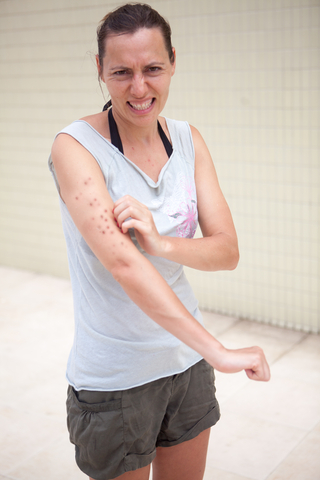 h skin rash