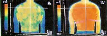 The Most Powerful Chronic Back, Neck, and Leg Pain Relief