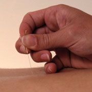Needle Your Pain Away? How Acupuncture Helps Your Back