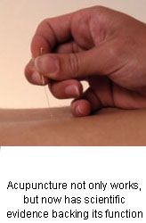 The Science Behind Acupuncture