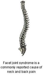 Is Facet Joint Syndrome Causing Your Neck &amp; Back Pain?