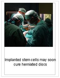 Can Spinal Discs Be Repaired By Stem Cells?