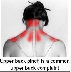 Dealing with an Upper Back Pinch