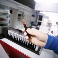 6 Unusual Ways to Detect Cancer