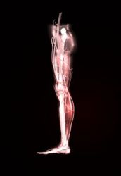 So, you’re suffering from sciatic pain?