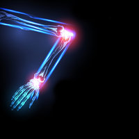 Free Arthritis and Joint Pain Relief Guide