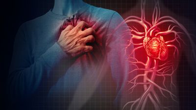 The Myths, Lies and True Causes of Heart Disease