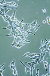 Can This Natural Secret Fight Cancer?