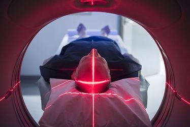 Do CT Scans Increase Your Cancer Risk?