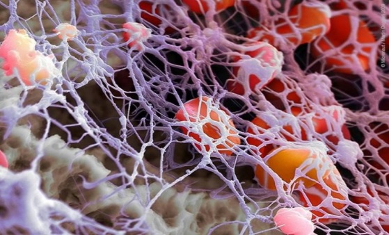 Fibrin Mesh