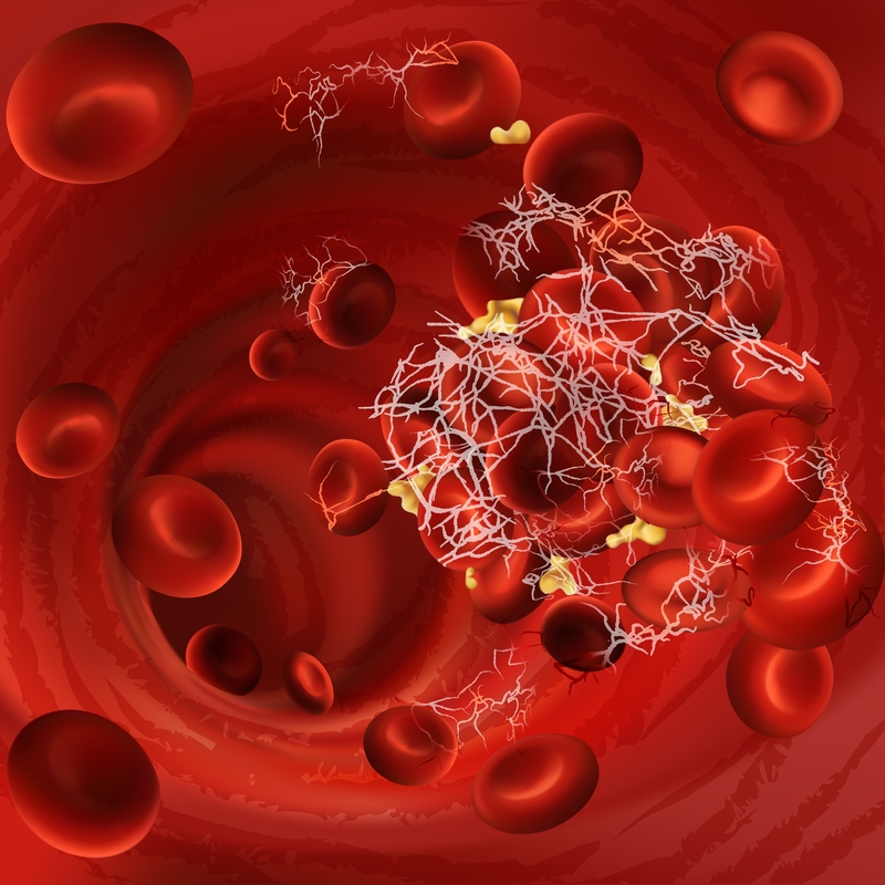 blood clot 