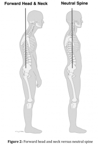 Forward Head Posture - What Causes This?