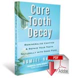 Cure Tooth Decay book