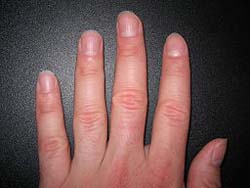 Healthy Fingernails