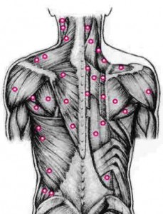 pinched nerve relief