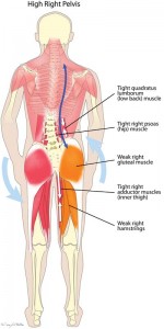 High Hip Muscle Imbalance