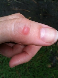 hive on thumb