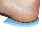 Do heel lifts cause back pain?